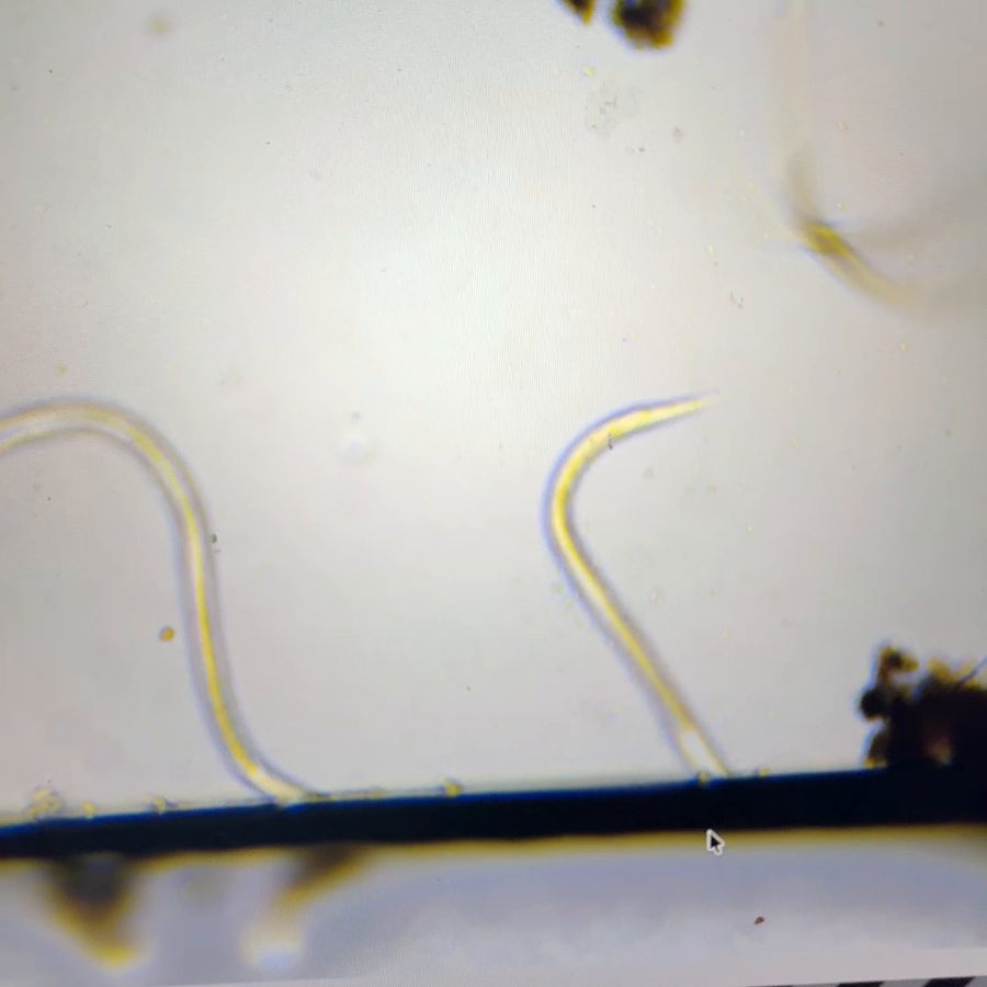 Two nematodes under the microscope, in a Bio-Complete extract sample